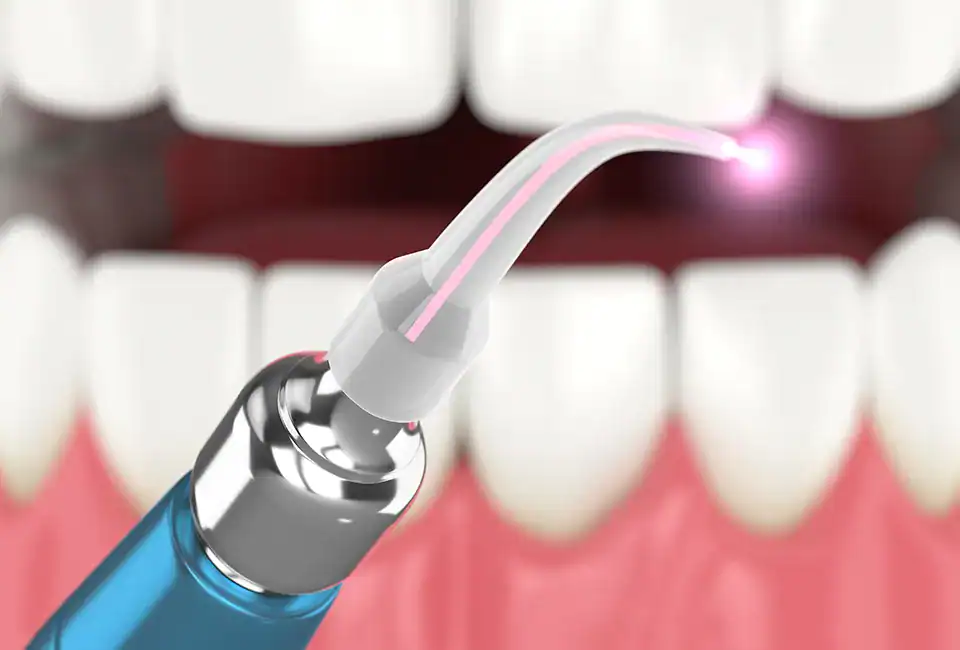 How Does Laser Therapy Speed Up Healing After Dental Treatment?