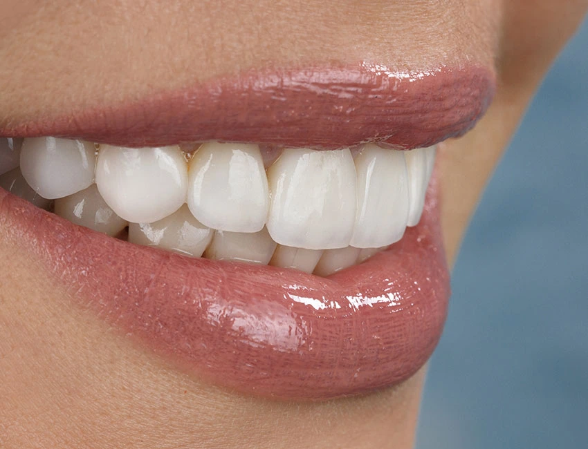 Cosmetic Dentistry at Smile Tustin by Dr. Ezzy