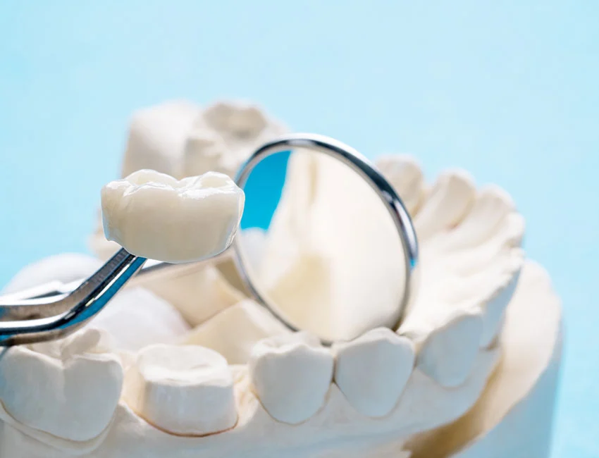 Restorative Dentistry at Smile Tustin by Dr. Ezzy