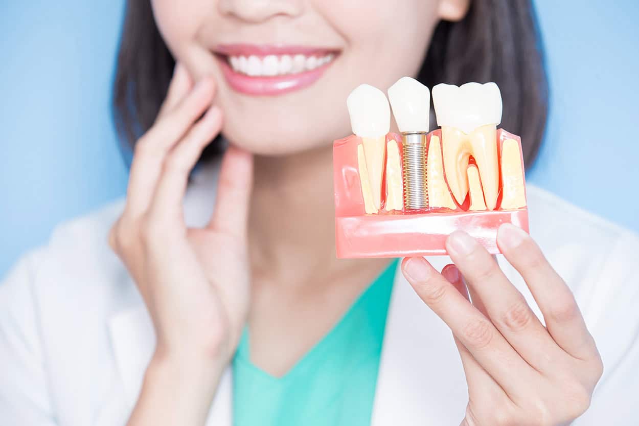 How Common Is Dental Implant Failure and What Causes It to Happen?