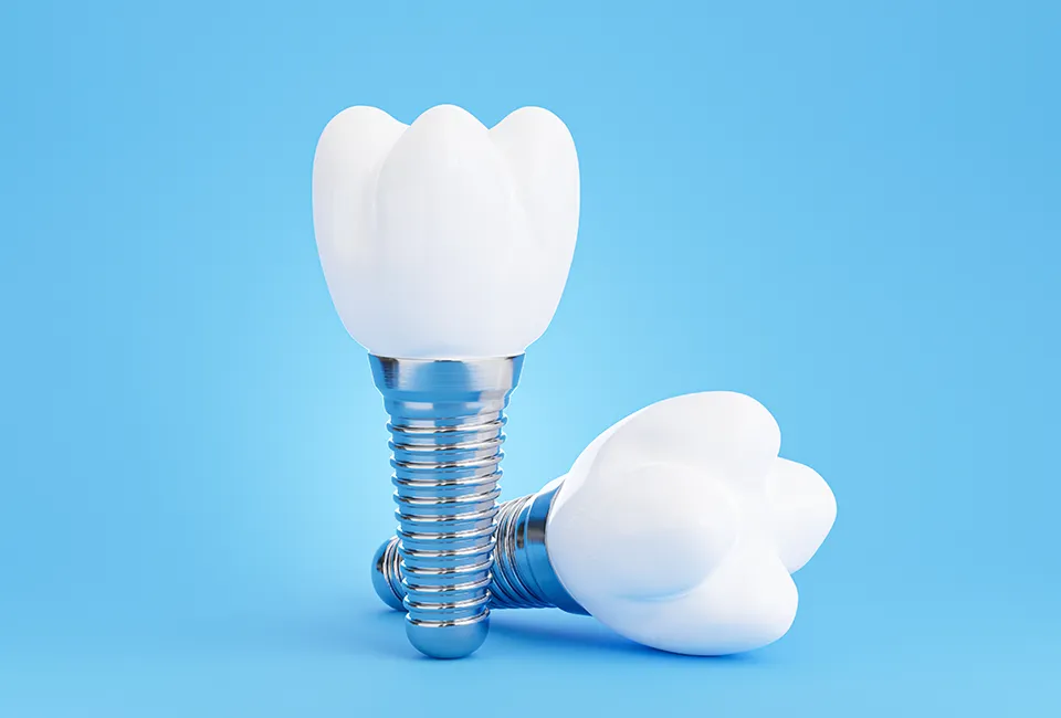 Can I Get Dental Implants If I Have Bone Loss?