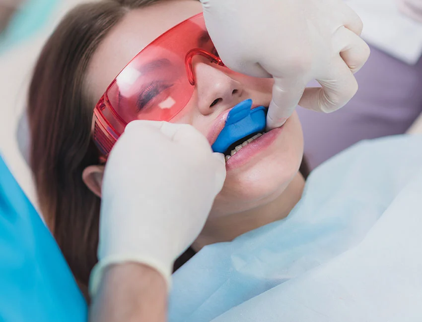 Fluoride Treatments at Smile Tustin by Dr. Ezzy