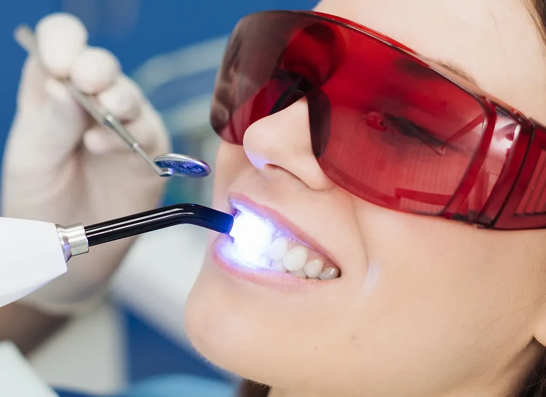 Laser Treatments in Tustin, CA