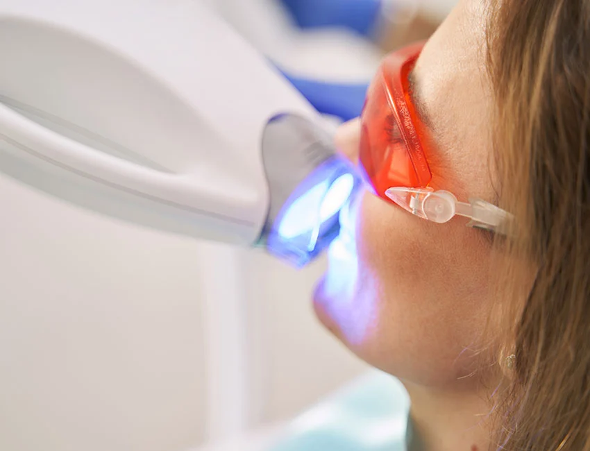 Laser Treatments at Smile Tustin by Dr. Ezzy