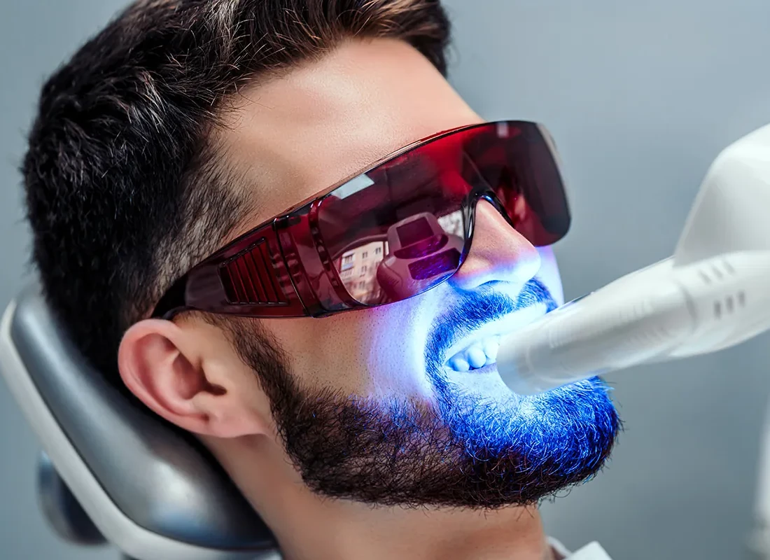 Teeth Whitening at Smile Tustin by Dr. Ezzy